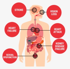 Health Threats Diagram - Effects Of High Blood Pressure, HD Png Download, Transparent PNG