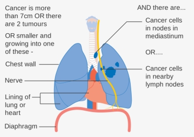 Clip Art Pictures Of Lung Cancer, HD Png Download, Transparent PNG