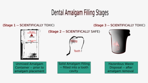 Dental Amalgam Filling Stages Clip Arts, HD Png Download, Transparent PNG