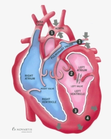 Clip Art Congestive Heart Failure Picture - Heart Failure Back Flow, HD Png Download, Transparent PNG