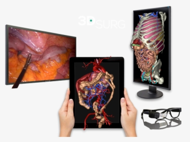 3d Technology Applied To Surgery - Graphic Design, HD Png Download, Transparent PNG