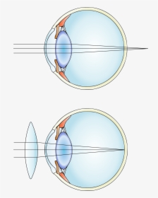 Hypermetropia And Correction - Convex Lens Uses, HD Png Download, Transparent PNG