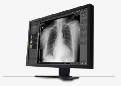 Carestream Image Suite, HD Png Download, Transparent PNG