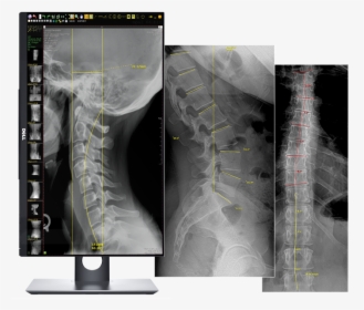 Chiropractic X Ray Machines, HD Png Download, Transparent PNG