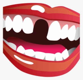 Transparent Brush Teeth Clipart - Missing Teeth Clipart, HD Png Download, Transparent PNG