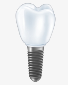 Dental Implant Png Clipart - Compact Fluorescent Lamp, Transparent Png, Transparent PNG