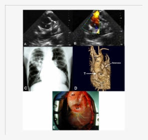Radiology, HD Png Download, Transparent PNG