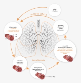 Physiology - Vicious Cycle - Vicious Cycle Of Bronchiectasis, HD Png Download, Transparent PNG