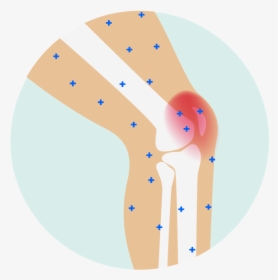 Pain Clipart Stiffness - Knee Pain Cartoon Png, Transparent Png, Transparent PNG