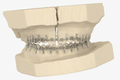 3d Printed Arch Bar - Scale Model, HD Png Download, Transparent PNG