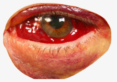 Eye Bloodshot Blood Redeye Bloodshoteyes Face Freetoedit Transparent Blood Shot Eyes Hd