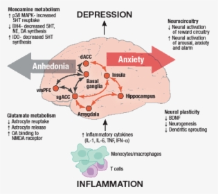 Inflammation Model Of Depression, HD Png Download, Transparent PNG