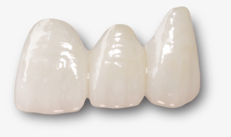 Dental Bridges Preston - Layered Zirconia Crown, HD Png Download, Transparent PNG