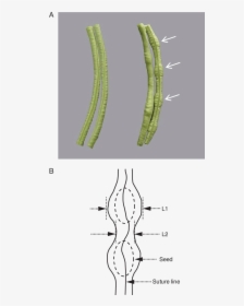 Difference Between Seed And Pod, HD Png Download, Transparent PNG