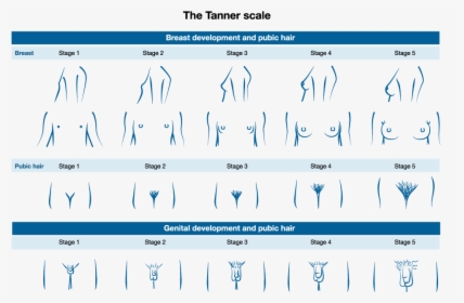 This Picture Depicts The Stages Of Pubic Hair Genital Tanner Scale Pubic Hair Hd Png Download Transparent Png Image Pngitem