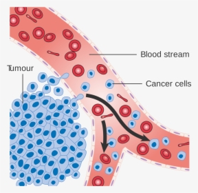 Do Cancer Cells Spread, HD Png Download, Transparent PNG
