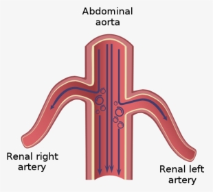 Turbulence In Abdominal Aorta Aneurisma - Aorta Addominale E Arteria Renale, HD Png Download, Transparent PNG