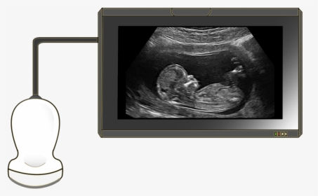 Ultrasound - Polyhydramnios Ultrasound, HD Png Download, Transparent PNG