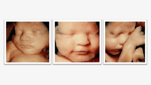 Ultrasound Photos - 4d Hd Ultrasound, HD Png Download, Transparent PNG