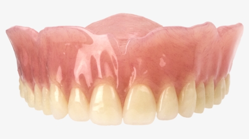 Bonded Case - Aspen Dental Upper Dentures, HD Png Download, Transparent PNG
