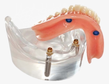 Stabilize Your Dentures And Regain Bite Strength, HD Png Download, Transparent PNG