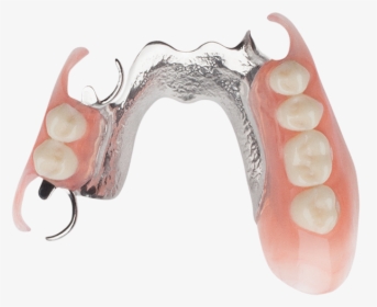 Single Dental Implant 1 - Dentistry, HD Png Download, Transparent PNG