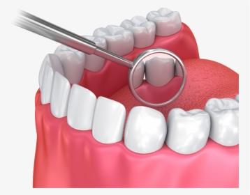 Brushing Teeth Png -illustration Of Dental Mirror And - Dentures, Transparent Png, Transparent PNG