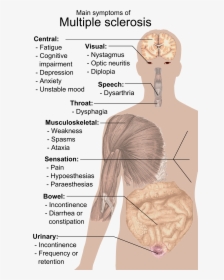 Symptoms Of Multiple Sclerosis - Esclerosis Multiple Del Sistema Nervioso, HD Png Download, Transparent PNG