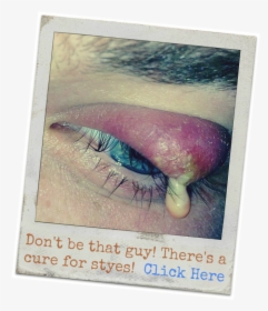 Does Putting A Tea Bag On Eyes Get Rid Of Styes - Warm Compress, HD Png Download, Transparent PNG