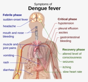 Dengue Fever Symptom, HD Png Download, Transparent PNG