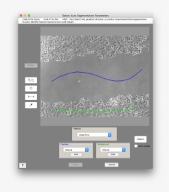 Fast Marching Methods Image Segmentation, HD Png Download, Transparent PNG