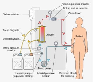 Hemodialysis Acts As An Artificial Kidney To Filter - Renal Dialysis, HD Png Download, Transparent PNG