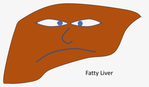 Non-alcoholic Fatty Liver Disease Clipart , Png Download, Transparent Png, Transparent PNG