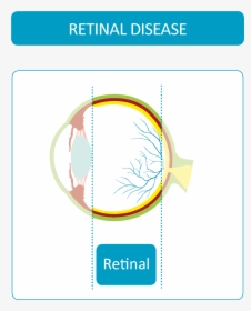 Retinal Diseases - Circle, HD Png Download, Transparent PNG