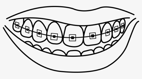 Collection Of With - Teeth With Braces Coloring Pages, HD Png Download, Transparent PNG