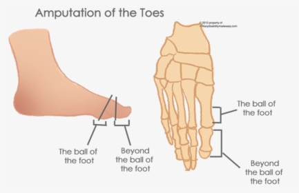 Transparent Toes Png - Partial Amputation Of Toe, Png Download, Transparent PNG