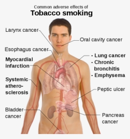 [​img] - Diseases In Circulatory System Caused By Smoking, HD Png Download, Transparent PNG
