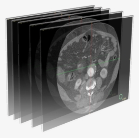 Dicom Image Icon, HD Png Download, Transparent PNG