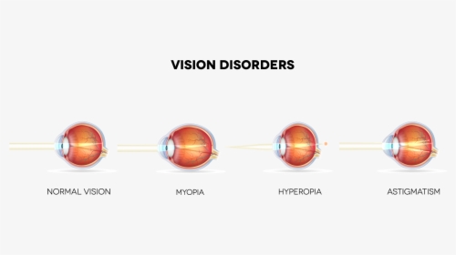 What Eye Conditions Does Lasik Treat Banner - Personal Health Issues And Concerns Vision, HD Png Download, Transparent PNG
