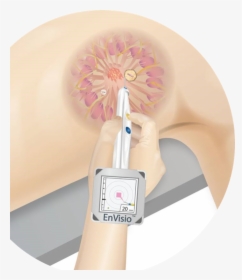 An Illustration Showing How The Elucent Device Pinpoints - Floral Design, HD Png Download, Transparent PNG