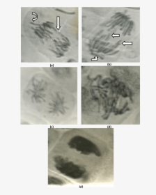 Abnormal Anaphase Cells Showing - Medical Imaging, HD Png Download, Transparent PNG