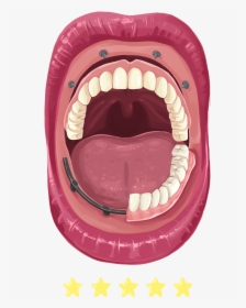 Missing Tooth, HD Png Download, Transparent PNG