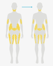 Fat Cells After Typical Weight Loss - Fat Cell Location On Body, HD Png Download, Transparent PNG