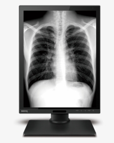 X-ray, HD Png Download, Transparent PNG