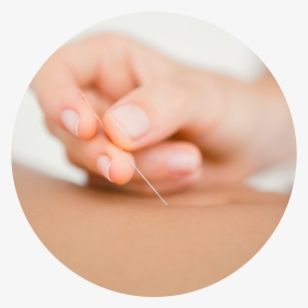 Acupuncture - Acupuncture Transparent, HD Png Download, Transparent PNG
