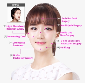 #hospital Perfect Makeover Plan - Bambi Eyelid Surgery, HD Png Download, Transparent PNG