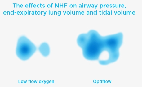 Optiflow High Flow Pressure Mechanism Overview - Teddy Bear, HD Png Download, Transparent PNG