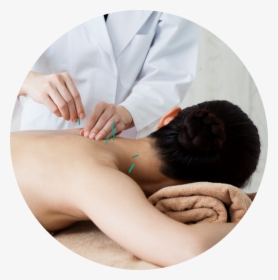 Acupuncture1 - Fisioterapia Em Acupuntura, HD Png Download, Transparent PNG