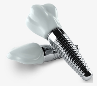 Dental Implants - Dental Implants Png, Transparent Png, Transparent PNG