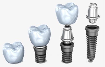 Implant Pieces Dental Implant Dentist Northborough - Implante Dental De Titanio, HD Png Download, Transparent PNG